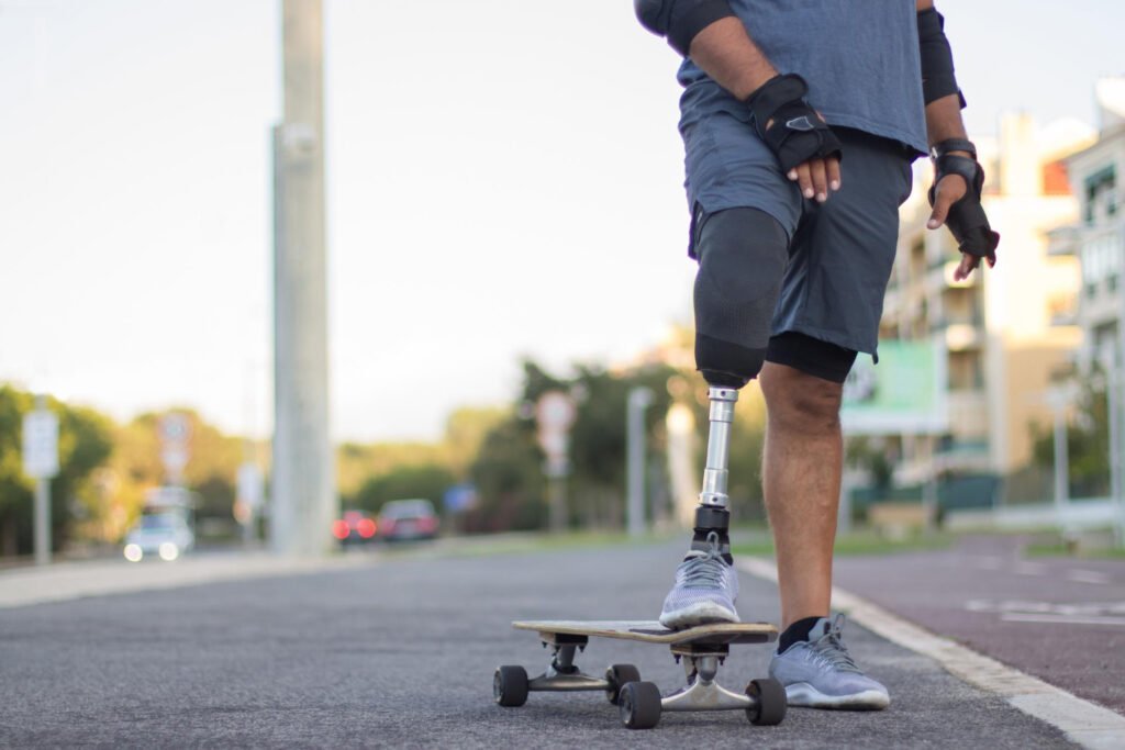 Prosthetic leg User using skateboard