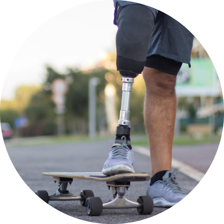 prosthetic leg user using skates