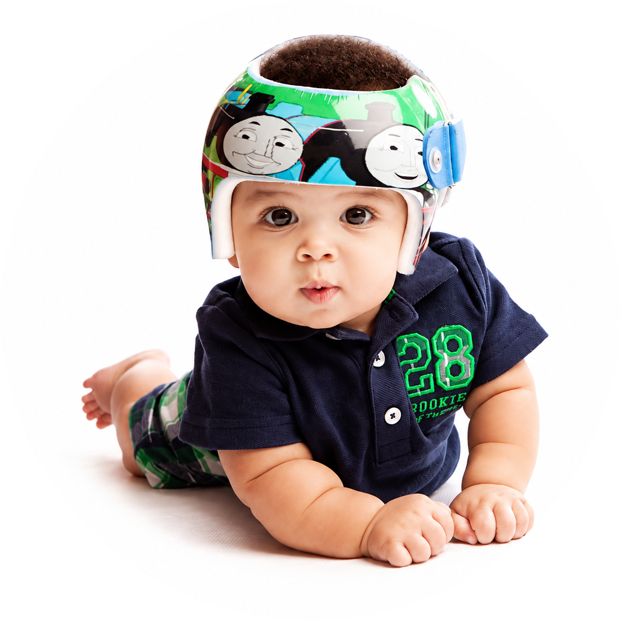 kid with cranial remoulding helmet